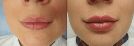 Permanent make-up de buze - îngrijire și vindecare după procedură, tehnici, preț, recenzii