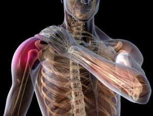 Плескіт плечового суглоба симптоми і лікування народними засобами