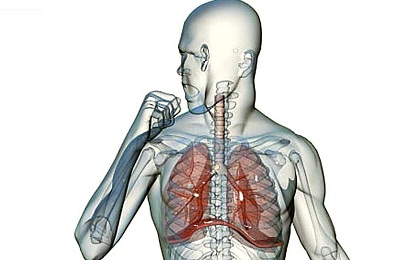 Tüdőgyulladás, tüdő tuberkulózis tünetek, okok és a kezelés