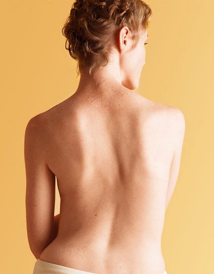 Jobb kéz gerincferdülés kezelésére és jellemzői (scoliosis) Kétoldalas gerincferdülés kezelésére és jellemzőit