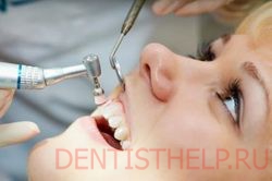 Реставраційне відбілювання зубів в Москві; переваги реставраційного відбілювання зубів