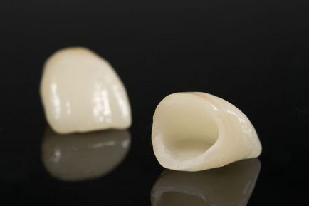 Sistemul Cerec din Moscova, prețul coroanelor pentru dinți și inserții - restaurarea dinților cerești în stomatologie
