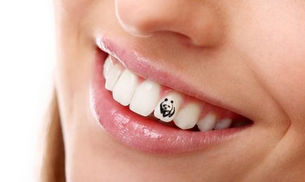 Стоматологія32 - пірсинг для зубів