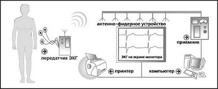 Tele-ecg monitorizare telemetrică eq în timp real, tredex