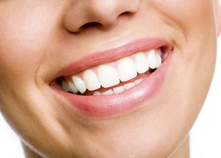 Doar recenzii reale despre sistemul de albire a dinților opalescence (opalescence)!