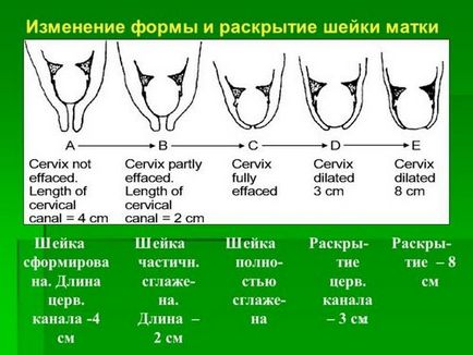 Тясната врата на раждането матката, матката по време на бременност