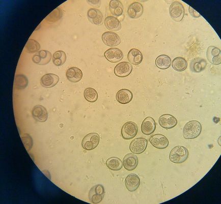 Részletek Euglena zöld (képviselő)