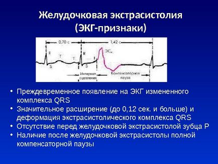 Шлуночкова екстрасистолія - ​​причини, симптоми, лікування