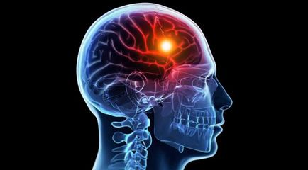 Extrasistolul ventricular - cauze, simptome, tratament