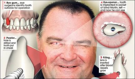 10 Cazuri de localizare nenaturală a dinților - factum