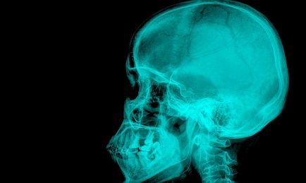 Imagine 3D dinte, sau tomografie computerizată a maxilarului