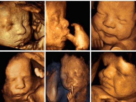 Uzi 3D în timpul sarcinii, indicații, pregătire,