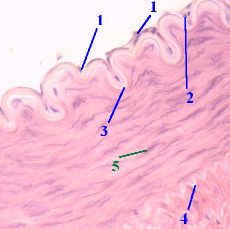 Artera de tip elastic