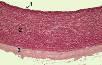 Artera de tip elastic