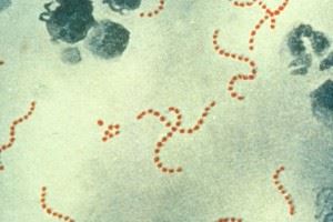 Bacterii streptococcus grup, boala, tratament