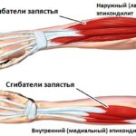 Бинт еластичний на коліно як бинтувати, пов'язка, яка фіксує, артрозі