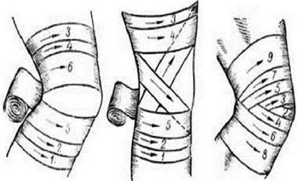 Bandaj elastic pe genunchi ca bandaj, bandaj, fixare, artroză