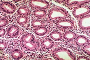 Biopsia descrierii metodei, normei Helicobacter pylori