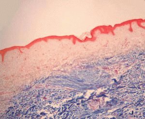 Biopsia descrierii metodei, normei Helicobacter pylori