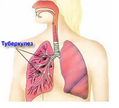 Хвороби органів дихання та їх попередження