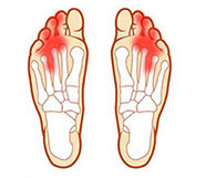 Біль у стопі причини гострого болю в стопі (без травми)