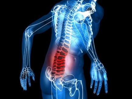 Rinichi sau dureri de spate cum să identifice și să recunoască simptomele durerii