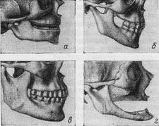 Cladiri inferioare ale structurii inferioare