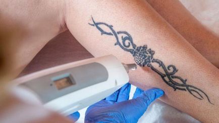 Ce poate fi un tatuaj periculos