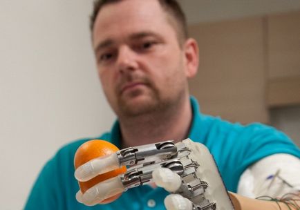 Minunea protezei 8 cea mai neobișnuită din lumea protezelor