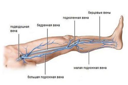 Stenozarea simptomelor de ateroscleroză și tratamentul