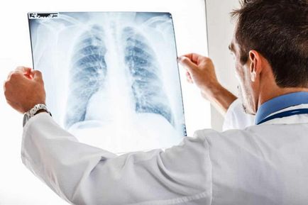 Dextrocardia inimii - semne, cauze și diagnostice