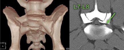 Diagnosticul sindromului radicular lombosacral