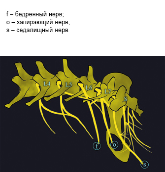 Diagnosticul sindromului radicular lombosacral