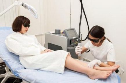 Diode laser îndepărtarea părului comentarii, video, contraindicații