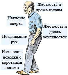 Чи ефективно лікування хвороби Паркінсона народними засобами