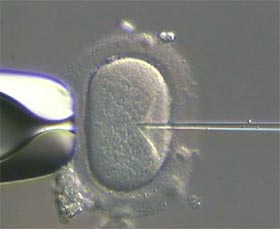Eco tanulni választani a klinikára (in vitro fertilizáció) Eco tanulni választani a klinikára