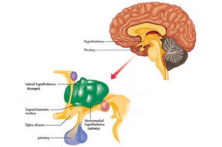 Exophthalmos - descriere, cauze, tratament