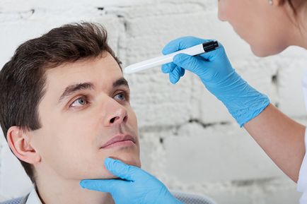 Exophthalmus - leírása, okok, kezelés (kezelés) Exophthalmus - leírása, okok, kezelés