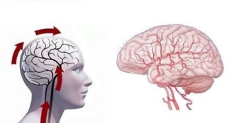 agy encephalopathia okai, tünetei és kezelése