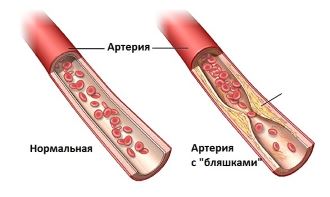 agy encephalopathia okai, tünetei és kezelése