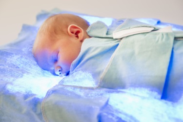 Фототерапія як метод лікування желтушки новонароджених