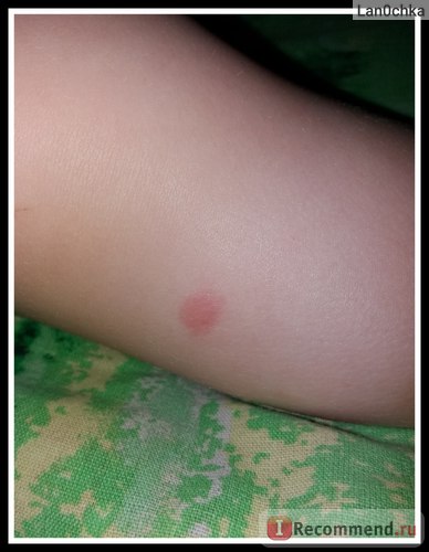 Gél balzsam után Mosquitall harap a rovarok, égések - «mosquitall, mert zakusali! Allergy (rovarok) Gél balzsam után Mosquitall harap a rovarok, égések - «mosquitall, mert zakusali! allergia
