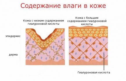 Гіалуронова кислота що це, користь і шкода гіалуронової кислоти для особи