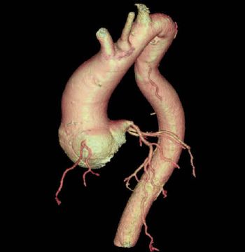 Гістологія і ультраструктура аорти - кардіолог - сайт про захворювання серця і судин