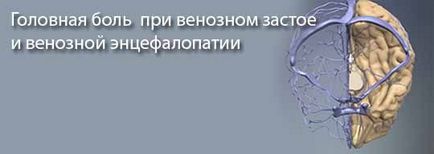 Головний біль при венозному застої і венозної недостатності