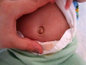 Hernia la simptomele băiatului nou-născut, tipuri, cauze
