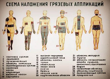 Tratarea cu nămol în Crimeea - sanatorii, metode, tipuri de noroi
