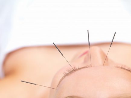 Tratamentul cu acupunctura a bolilor sistemului respirator