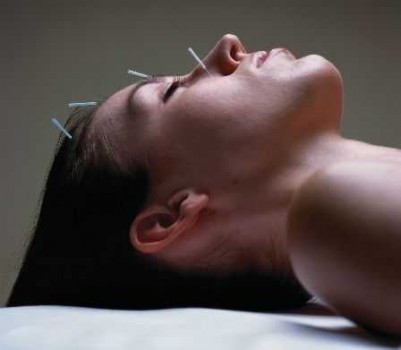 Tratamentul cu acupunctura a bolilor sistemului respirator