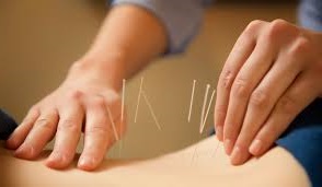 Az akupunktúra - az előnyöket és a hátrányokat az akupunktúra